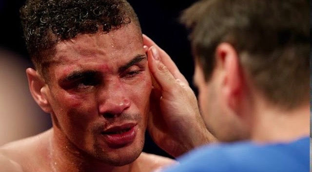 ANTHONY OGOGO - LIFE AFTER PRO SPORT